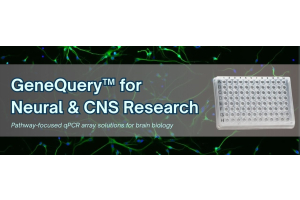 GeneQuery™: Comprehensive Solutions for Neural Biology and CNS Disease Research