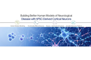 Advancing Neurological Disease Research with Human Cortical Neuron Models
