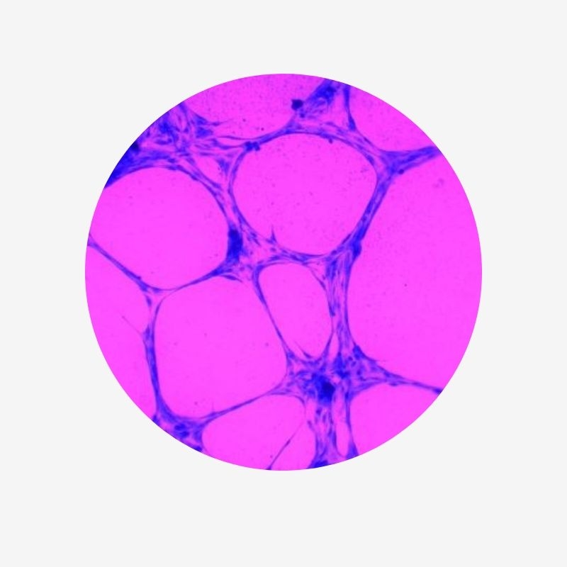 In Vitro Tube Formation Assay