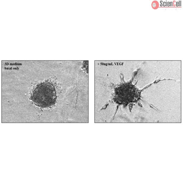 Collagen-embedded HUVEC spheroids at 24 hours post VEGF-stimulation