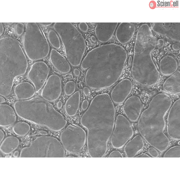 Cells day 4 of assay, 100x (day 4 cond1-10x)
