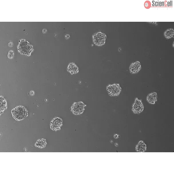 Days 3; 3D Human Blood Brain Barrier Spheroids (At 100X magnification). 