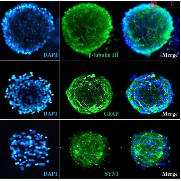 Human Cortical Spheroids at Day 7