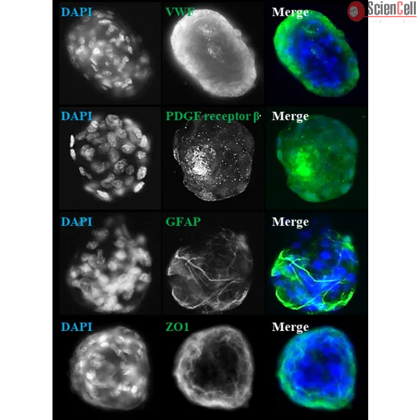 Days 7; IF analysis of rat blood brain barrier spheroids