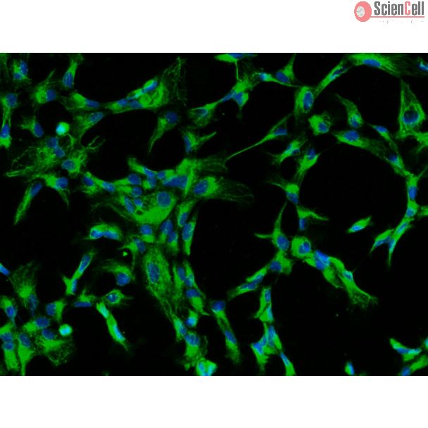 Bovine Lens Epithelial Cells (BLEpiC)-Immunostaining for CK-18, 200X.