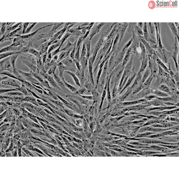 Dog Mesenchymal Stem Cells-adipose (DMSC-ad) - Phase contrast, 200x.
