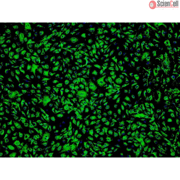 Human Adipose Microvascular Endothelial Cells (HAMEC) - Immunostaining for vWF, 100x.
