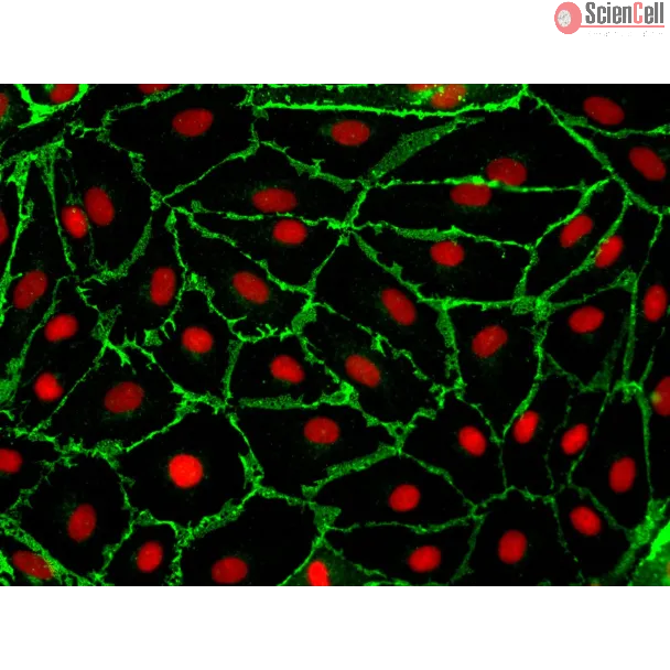 Human Adrenal Microvascular Endothelial Cells (HAdMEC) – Immunostaining for CD31, 400x.
