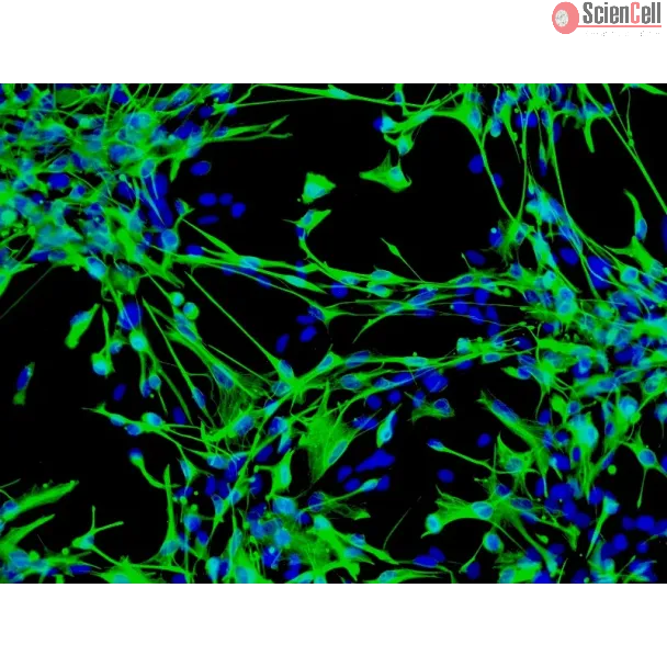 Human Astrocytes-brain stem (HA-bs) - mmunostaining for GFAP, 100x.
