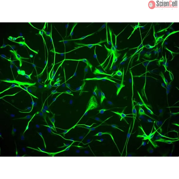 Human Astrocytes-hippocampal (HA-h) - Immunostaining for GFAP, 200x.
