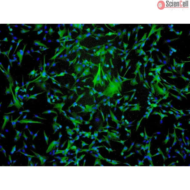 Human Astrocytes-midbrain (HA-mb) - Immunostaining for GFAP, 100x.
