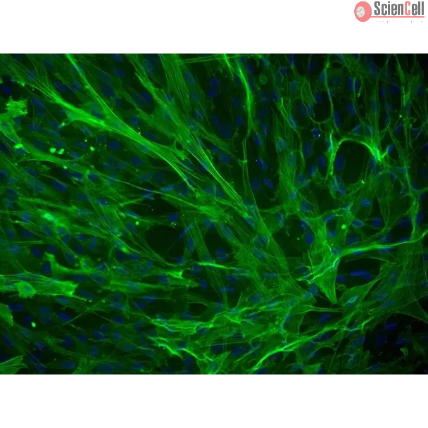 Human Bladder Smooth Muscle Cells (HBdSMC) - Immunostaining for α-SMA, 200x.
