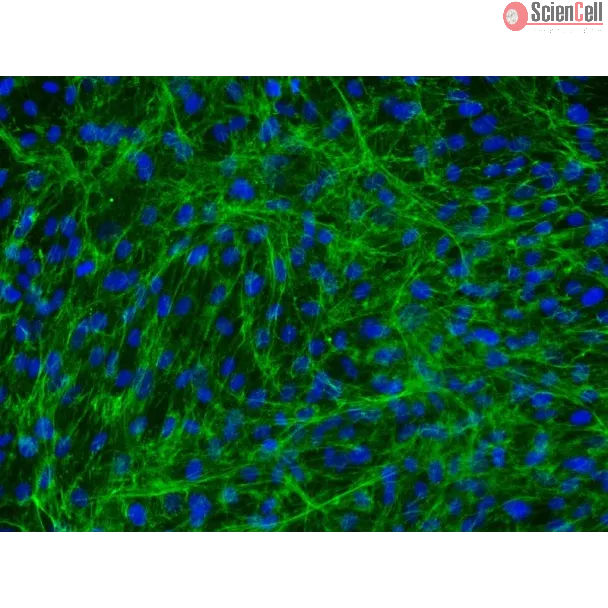 Human Bladder Stromal Fibroblasts (HBdSF) - Immunostaining for Fibronectin, 200x.
