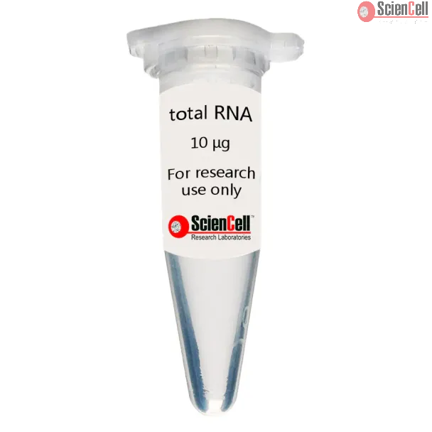 Human Brain Vascular Smooth Muscle Cell Total RNA