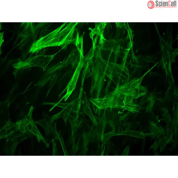Human Brain Vascular Smooth Muscle Cells [HBVSMC] - Immunostaining for α-SMA, 400x.
