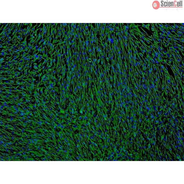 Human Bronchial Fibroblasts (HBF) - Immunostaining for Fibronectin, 100x.
