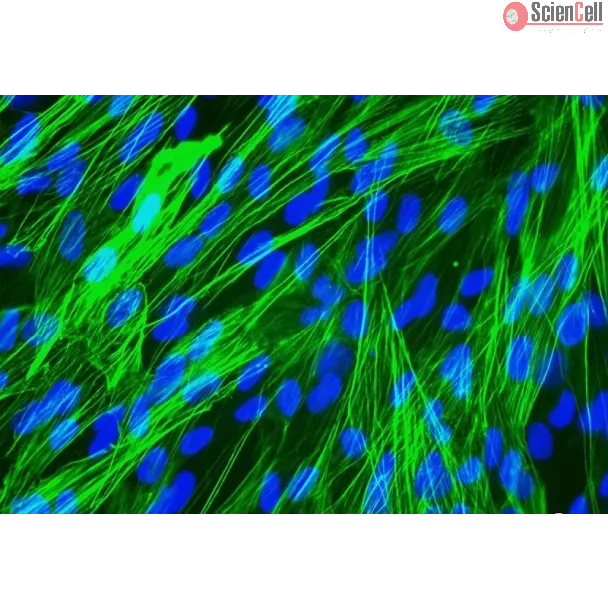 Human Bronchial Smooth Muscle Cells (HBSM) - Immunostaining for .
