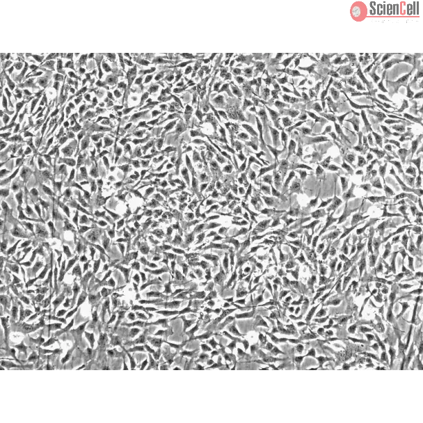 Human Chondrocytes-articular (HC-a) - Phase contrast, 100x.
