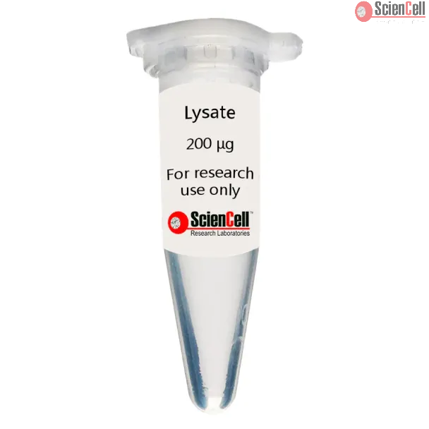 Human Choroid Plexus Endothelial Cell Lysate