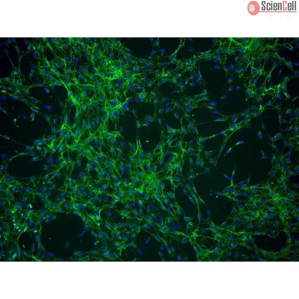 Human Choroid Plexus Fibroblasts (HCPF) - Immunostaining for Fibronectin, 100x.
