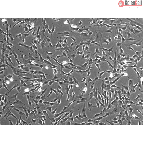Human Colonic Fibroblasts (HCoF)- Phase Contrast, 100x
