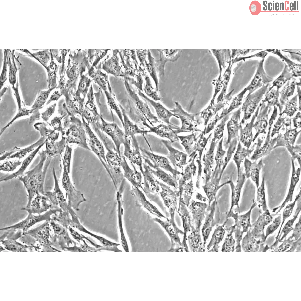 Human Colonic Smooth Muscle Cells (HCoSMC) - Phase contrast, 200x.
