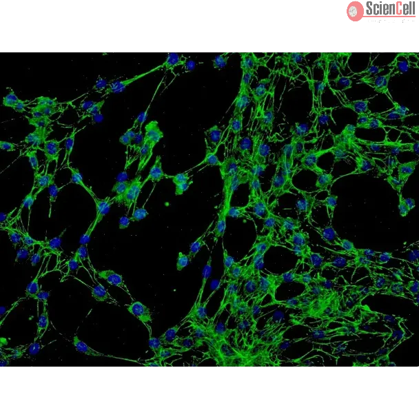 Human Conjunctival Fibroblasts (HConF) - Immunostaining for Fibronectin, 200x.
