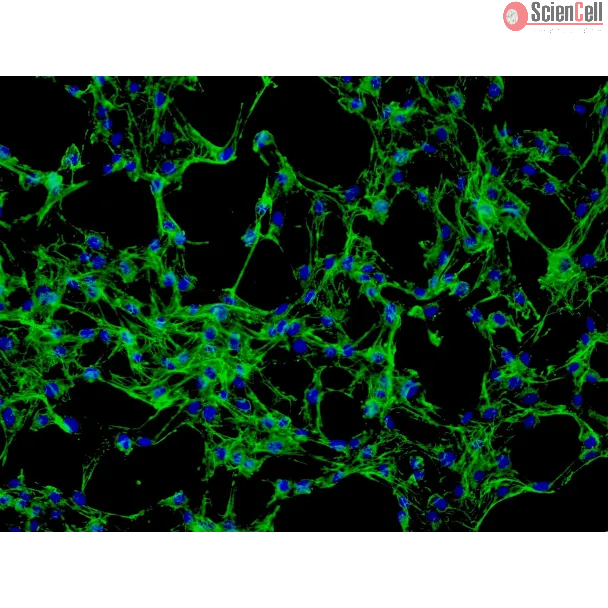 Human_Dermal_Fibroblasts-adult (HDF-a) - Immunostaining for Fibronectin, 200x.
