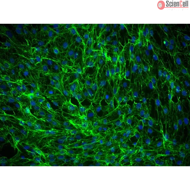 Human Dermal Fibroblasts-Fetal-Mitomycin C treated (HDF-f-mt) - Immunostaining for Fibronectin, 200x.
