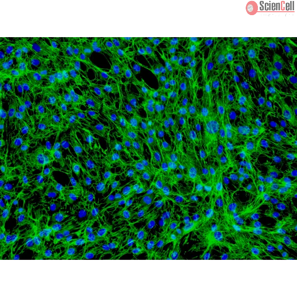 Human Dermal Fibroblasts-neonate (HDF-n) - Immunostaining for Fibronectin, 200x.
