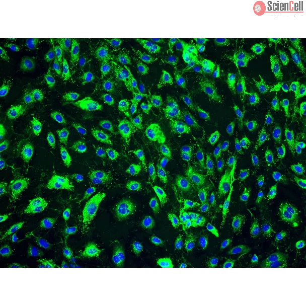 Human Dermal Lymphatic Endothelial Cells (HDLEC) - Immunostaining for vWF, 200x.
