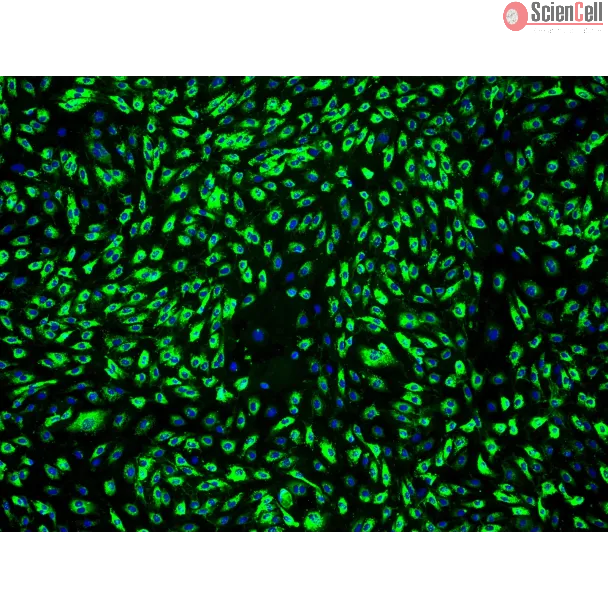 Human Dermal Microvascular Endothelial Cells-adult (HDMEC-a) - Immunostaining for vWF, 100x.
