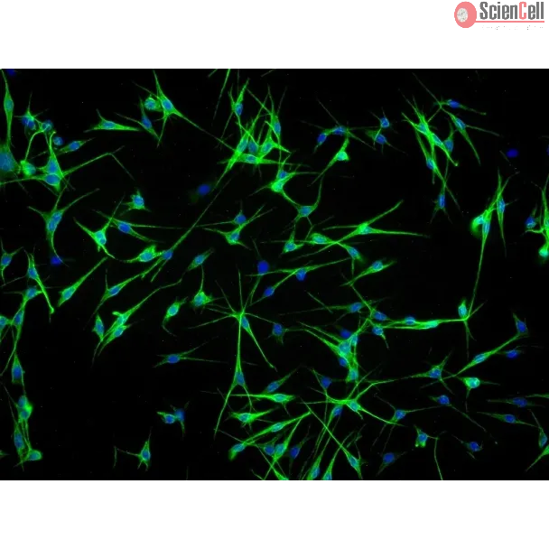 Human Epidermal Melanocyte-adult (HEM-a) - Immunostaining for S100-β, 100x.
