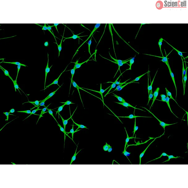 Human Epidermal Melanocytes-dark (HEM-d) - Immunostaining for Vimentin, 200x.
