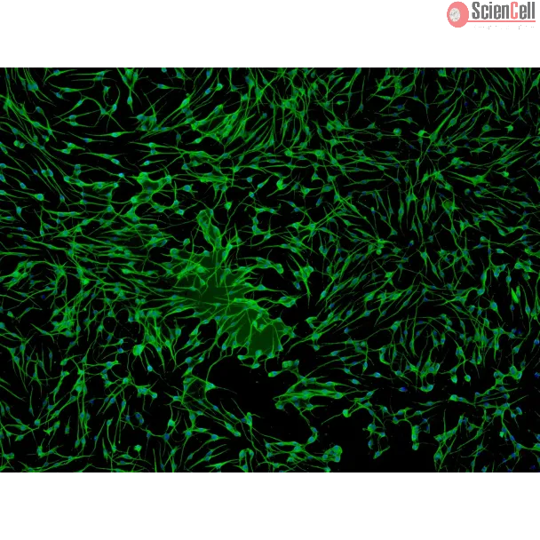 Human Epidermal Melanocytes-light (HEM-l) - Immunostaining for S100-β, 100x.
