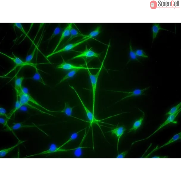 Human Epidermal Melanocytes-medium (HEM-m) - Immunostaining for S100-β, 400x.
