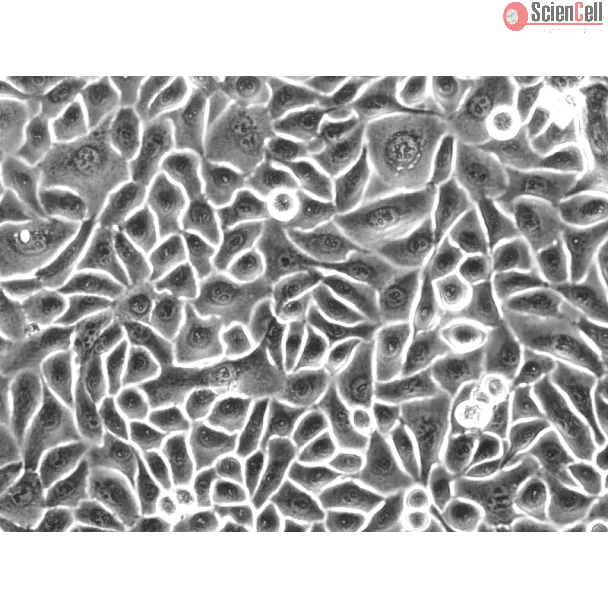 Human Esophageal Epithelial Cells (HEEpiC) - Phase contrast, 200x.
