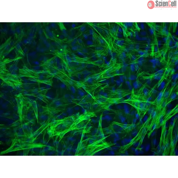 Human Esophageal Smooth Muscle Cells (HESMC) - Immunostaining for α-SMA, 200x.
