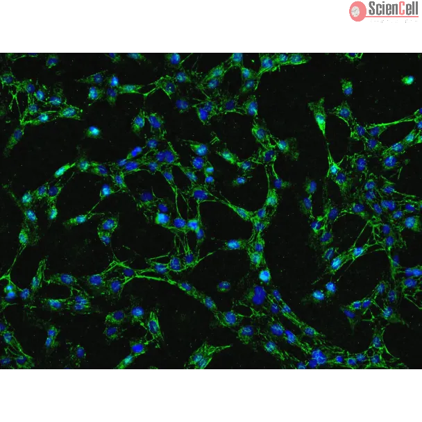 Human Gastric Fibroblasts (HGF)-Immunostaining for FN (Sigma-Aldrich, Cat#3648), 200x.
