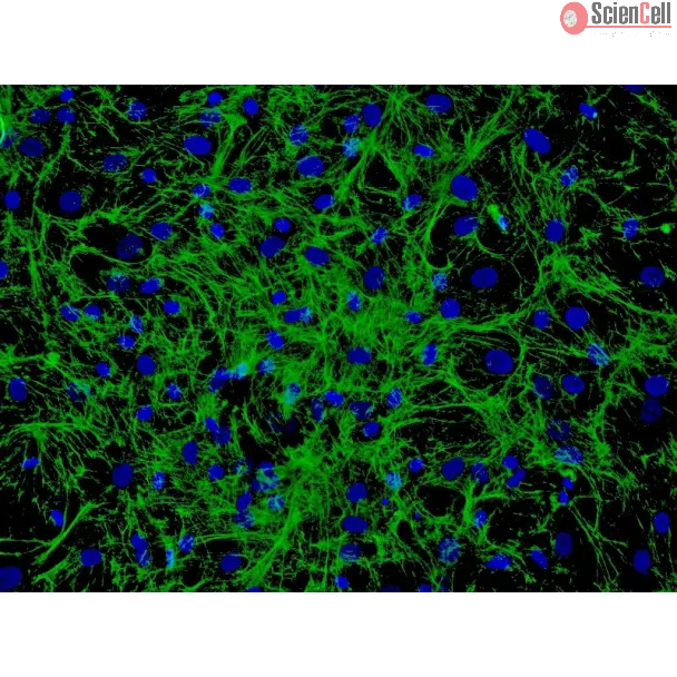 Human Hair Germinal Matrix Cells (HHGMC) - Immunostaining for Fibronectin, 200x.
