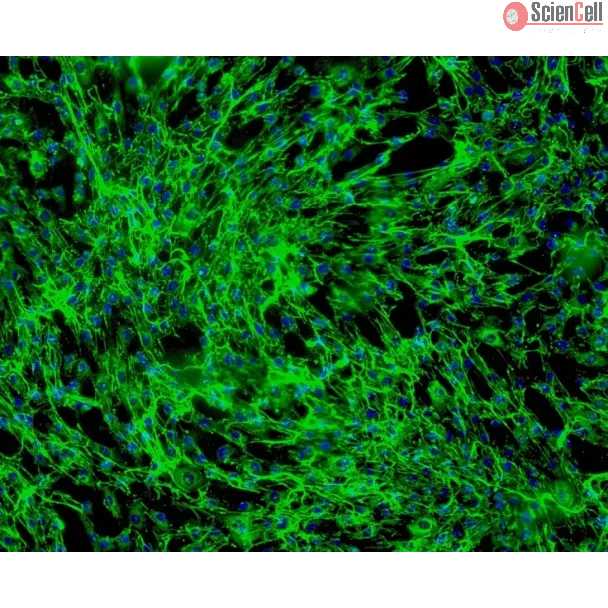Human Hair Inner Root Sheath Cells (HHIRSC) - Immunostaining for Fibronectin, 100x.
