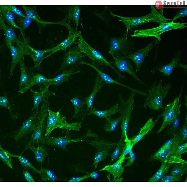 Human Hepatic Stellate Cells (HHSteC) - Immunostaining for α-SMA, 400x.
