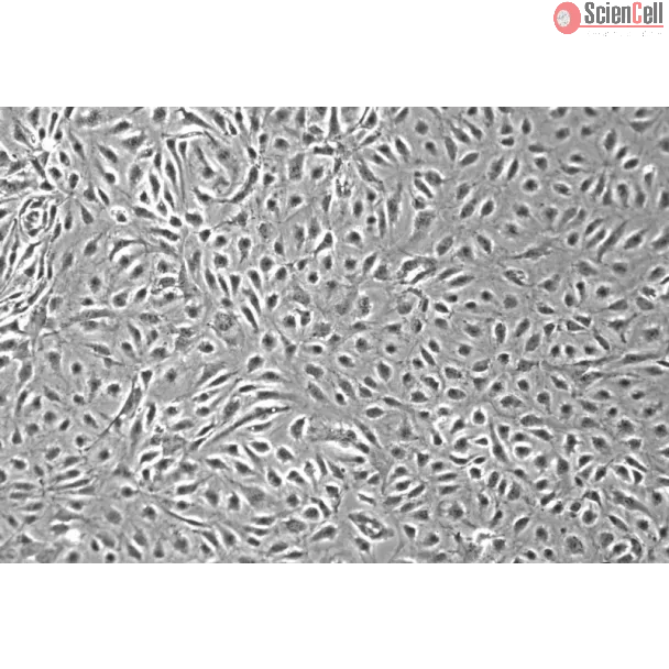 Human Intestinal Microvascular Endothelial Cells (HIMEC) - Phase contrast, 100x.
