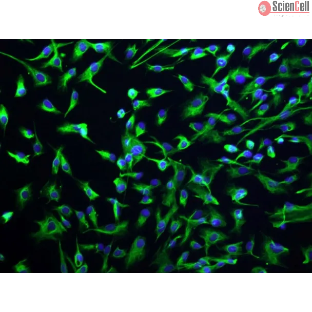 Human Intrahepatic Biliary Epithelial Cells (HIBEpiC)-Immunostaining for CK-18 (Sigma -Aldrich, Cat. #C1399), 200x.
