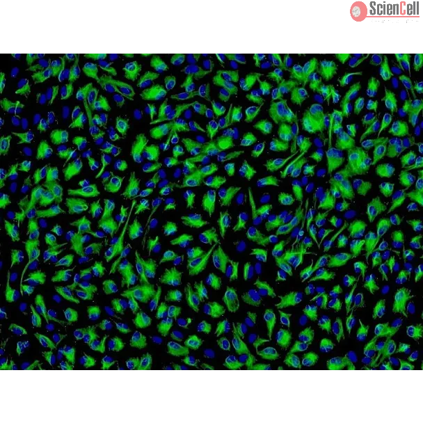 Human Iris Pigment Epithelial Cells (HIPEpiC) - Immunostaining for CK-18, 200x.
