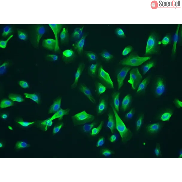 Human_Leydig Cells (HLC) Immunostaining for CK-18, 200x..
