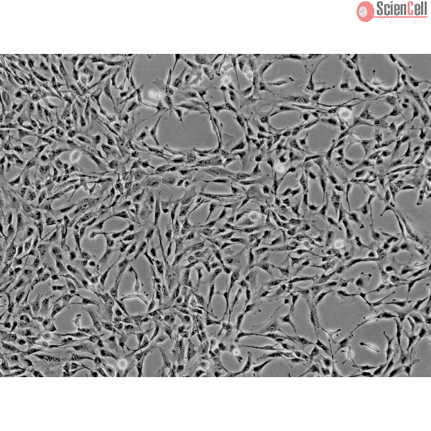 Human Liver-derived Mesenchymal Stem Cells (HMSC-he) - Phase contrast, 100x.
