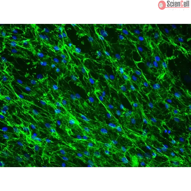 Human Lymphatic Fibroblasts (HLF) - Immunostaining for Fibronectin, 200x.
