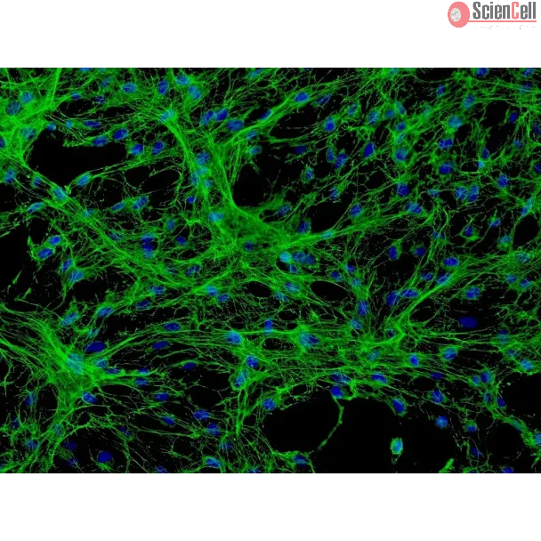 Human Meningeal Cells (HMC) - Immunostaining for Fibronectin, 200x.
