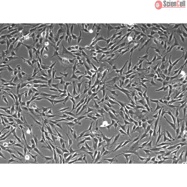 Human Mesenteric Fibroblasts (HMeF)-Phase Contrast, 100x
